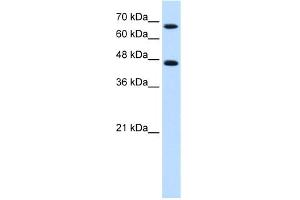 WB Suggested Anti-NR4A2 Antibody Titration:  0. (NR4A2 Antikörper  (C-Term))