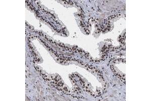 Immunohistochemical staining of human prostate with PHF12 polyclonal antibody  shows strong nuclear positivity in glandular cells. (PHF12 Antikörper)