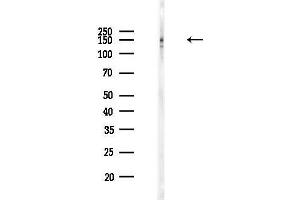 anti-PDS5, Regulator of Cohesion Maintenance, Homolog B (PDS5B) (C-Term) antibody
