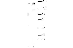 AIB1 antibody (pAb) tested by Western blot. (NCOA3 Antikörper)