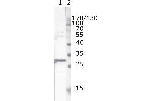 Western Blot testing of HIV-1 recombinant Nef protein. (HIV-1 Nef (AA 163-173) Antikörper)