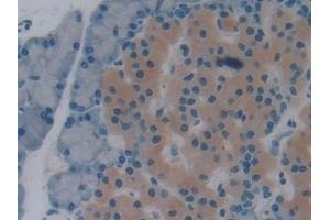 Immunohistochemistry (IHC) image for anti-Thioredoxin Reductase 1 (TXNRD1) (AA 208-433) antibody (ABIN7442870)