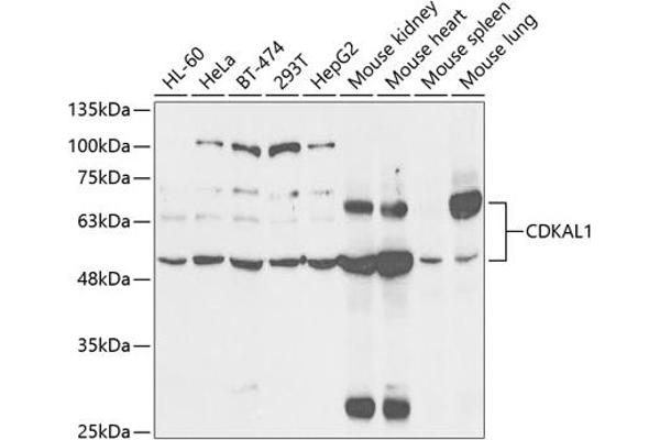 CDKAL1 Antikörper  (AA 1-230)