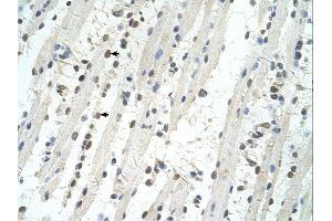 Immunohistochemistry (IHC) image for anti-Tripartite Motif Containing 32 (TRIM32) (C-Term) antibody (ABIN309924) (TRIM32 Antikörper  (C-Term))