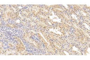 Detection of HIF2a in Human Kidney Tissue using Polyclonal Antibody to Hypoxia Inducible Factor 2 Alpha (HIF2a) (EPAS1 Antikörper  (AA 26-347))