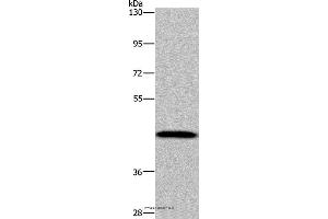 Western blot analysis of Human hepatocellular carcinoma tissue, using CYP1A2 Polyclonal Antibody at dilution of 1:440 (CYP1A2 Antikörper)