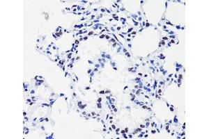 Immunohistochemistry of paraffin-embedded Rat lung using Acetyl-Histone H2B-K15 Polyclonal Antibody at dilution of 1:100 (40x lens). (Histone H2B Antikörper  (acLys15))