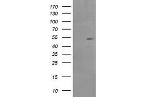 HEK293T cells were transfected with the pCMV6-ENTRY control (Left lane) or pCMV6-ENTRY AP2M1 (Right lane) cDNA for 48 hrs and lysed. (AP2M1 Antikörper  (AA 97-383))