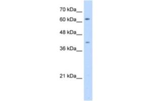 Western Blotting (WB) image for anti-SWAP Switching B-Cell Complex 70kDa Subunit (SWAP70) antibody (ABIN2462957) (SWAP70 Antikörper)