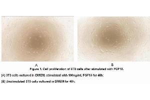 Image no. 2 for Fibroblast Growth Factor 13 (FGF13) (AA 1-192) (Active) protein (His tag) (ABIN6239865) (FGF13 Protein (AA 1-192) (His tag))