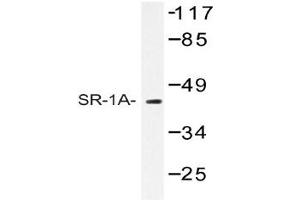 Image no. 1 for anti-Serotonin Receptor 1A (HTR1A) antibody (ABIN272268) (Serotonin Receptor 1A Antikörper)