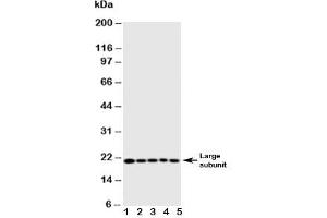 Western blot testing of Caspase-4 antibody and Lane 1:  MCF-7;  2: HeLa;  3: Jurkat;  4: CEM;  5: SW620 cell lysate (Caspase 4 Antikörper  (AA 104-124))