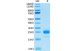 Human IL-4 on Tris-Bis PAGE under reduced condition. (IL-4 Protein (His-Avi Tag))