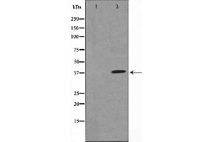 Western blot analysis of IkappaB-alpha expression in TNF-α treated MCF7 whole cell lysates,The lane on the left is treated with the antigen-specific peptide. (NFKBIA Antikörper  (N-Term))