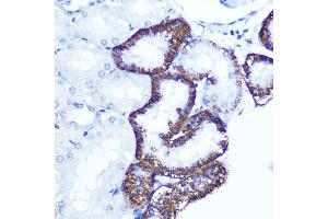 Immunohistochemistry of paraffin-embedded rat kidney using EXTL3 Rabbit pAb (ABIN1679782, ABIN3018195, ABIN3018196 and ABIN6220395) at dilution of 1:100 (40x lens). (EXTL3 Antikörper  (AA 52-220))