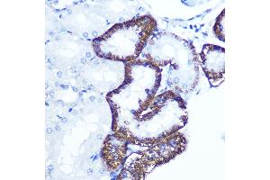 Immunohistochemistry of paraffin-embedded rat kidney using EXTL3 Rabbit pAb (ABIN1679782, ABIN3018195, ABIN3018196 and ABIN6220395) at dilution of 1:100 (40x lens).
