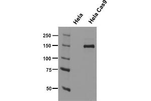 Cas9 antibody (mAb) tested by Western blot. (CRISPR-Cas9 Antikörper)