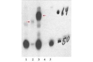 THRB Antikörper  (Isoform 1, N-Term)