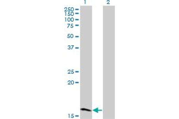 Zinc Finger Protein 44 Antikörper  (AA 1-103)