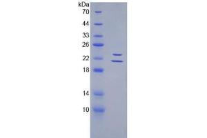SDS-PAGE analysis of Mouse Endothelin 1 Protein. (Endothelin 1 Protein (EDN1))