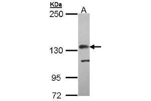 WB Image Sample (30 ug of whole cell lysate) A: Molt-4 , 5% SDS PAGE antibody diluted at 1:5000 (Complement Factor H Antikörper)