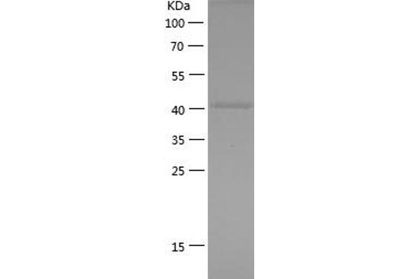 HDAC2 Protein (AA 386-488) (His-IF2DI Tag)