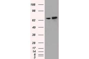 Western Blotting (WB) image for anti-Sorting Nexin 9 (SNX9) antibody (ABIN1501045)