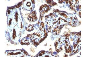 Image no. 3 for anti-CD34 (CD34) antibody (ABIN6185811)