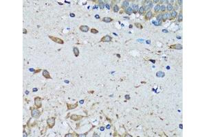 Immunohistochemistry of paraffin-embedded Mouse brain using FDFT1 Polyclonal Antibody at dilution of 1:100 (40x lens). (FDFT1 Antikörper)
