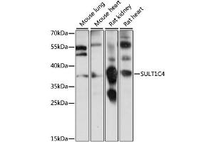 Western blot analysis of extracts of various cell lines, using SULT1C4 antibody (ABIN6293706) at 1:1000 dilution.