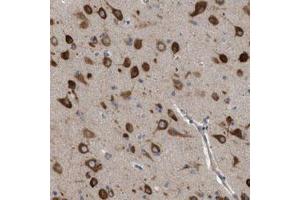 Immunohistochemical staining (Formalin-fixed paraffin-embedded sections) of human cerebral cortex with IL1RL2 polyclonal antibody  shows strong cytoplasmic positivity in neuronal cells at 1:50-1:200 dilution. (IL1RL2 Antikörper)