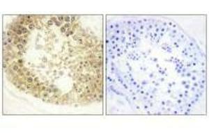 Immunohistochemistry analysis of paraffin-embedded human testis tissue, using ECRG4 antibody. (MEMO1 Antikörper)