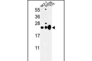 Western blot analysis of CBX1 Antibody (C-term) (ABIN652861 and ABIN2842560) in MCF-7, , Y79 cell line lysates (35 μg/lane).