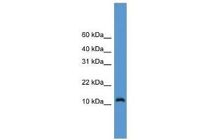 Western Blot showing CDC26 antibody used at a concentration of 1-2 ug/ml to detect its target protein. (CDC26 Antikörper  (Middle Region))