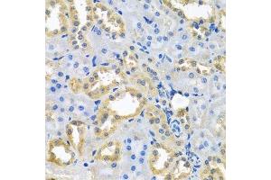 Immunohistochemistry of paraffin-embedded rat kidney using NDUFB10 antibody.