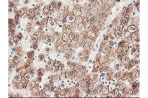 Immunohistochemical staining of paraffin-embedded Human liver tissue using anti-CYP2J2 mouse monoclonal antibody. (CYP2J2 Antikörper)