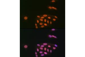 Immunofluorescence analysis of U-2 OS cells using K/MYST1/MOF Rabbit mAb (ABIN7268063) at dilution of 1:100 (40x lens). (MYST1 Antikörper)