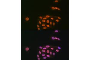 Immunofluorescence analysis of U-2 OS cells using K/MYST1/MOF Rabbit mAb (ABIN7268063) at dilution of 1:100 (40x lens). (MYST1 Antikörper)