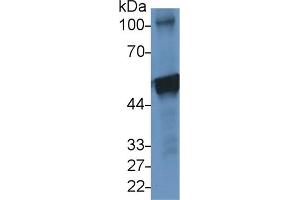 Detection of CK10 in Human A431 cell lysate using Polyclonal Antibody to Cytokeratin 10 (CK10) (Keratin 10 Antikörper  (AA 153-456))