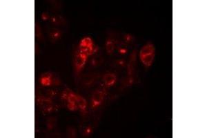 Immunofluorescent analysis of HAI-1 staining in Hela cells. (SPINT1 Antikörper)