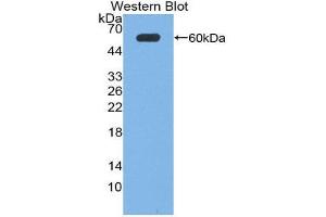 Western Blotting (WB) image for anti-Neuronal Pentraxin 1 (NPX1) (AA 115-364) antibody (ABIN1869514) (NPX1 Antikörper  (AA 115-364))