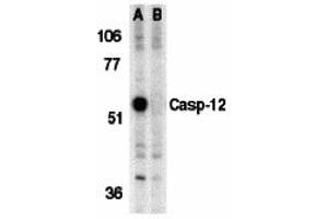 Western Blotting (WB) image for anti-Caspase 12 (Gene/pseudogene) (CASP12) (Middle Region) antibody (ABIN1030898)