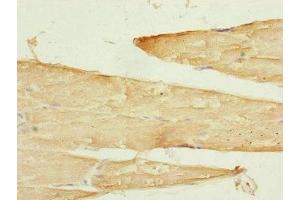 Immunohistochemistry of paraffin-embedded human skeletal muscle tissue using ABIN7170343 at dilution of 1:100 (SAMM5 (AA 1-220) Antikörper)