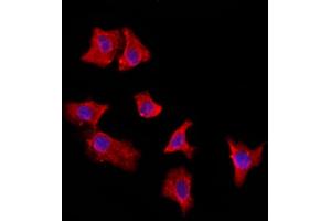 ABIN6264959 and ABIN6272887 staining HepG2 by IF/ICC. (EXOC2 Antikörper  (N-Term))