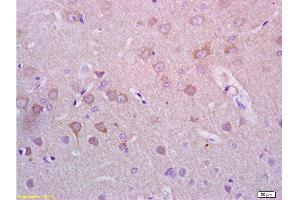 Formalin-fixed and paraffin embedded rat brain tissue with labeled Anti-Alpha-Synuclein/Syn/SNCA Polyclonal Antibody, Unconjugated  at 1:200, followed by conjugation to the secondary antibody and DAB staining (SNCA Antikörper  (AA 1-140))