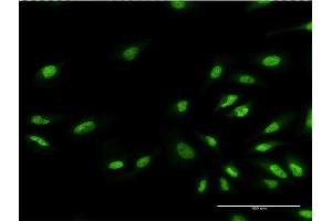 Immunofluorescence of monoclonal antibody to EHMT1 on HeLa cell. (EHMT1 Antikörper  (AA 1-100))