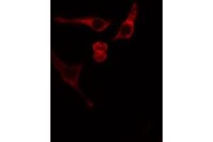ABIN6275839 staining Hela cells by IF/ICC. (MATK Antikörper  (Internal Region))
