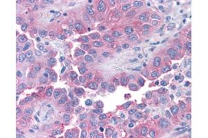 Immunohistochemistry (IHC) image for anti-Taste Receptor, Type 1, Member 1 (TAS1R1) (Cytoplasmic Domain) antibody (ABIN1049396)