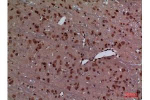 Immunohistochemistry (IHC) image for anti-Homeobox D3 (HOXD3) (Internal Region) antibody (ABIN3187731)