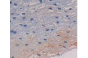 IHC-P analysis of Human Tissue, with DAB staining. (Cytokeratin 13 Antikörper  (AA 104-403))